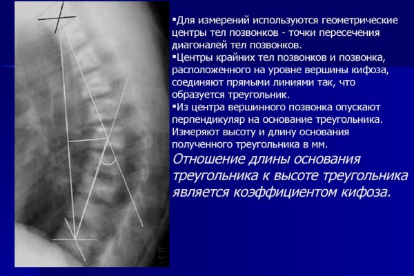 Сайты с наркотой